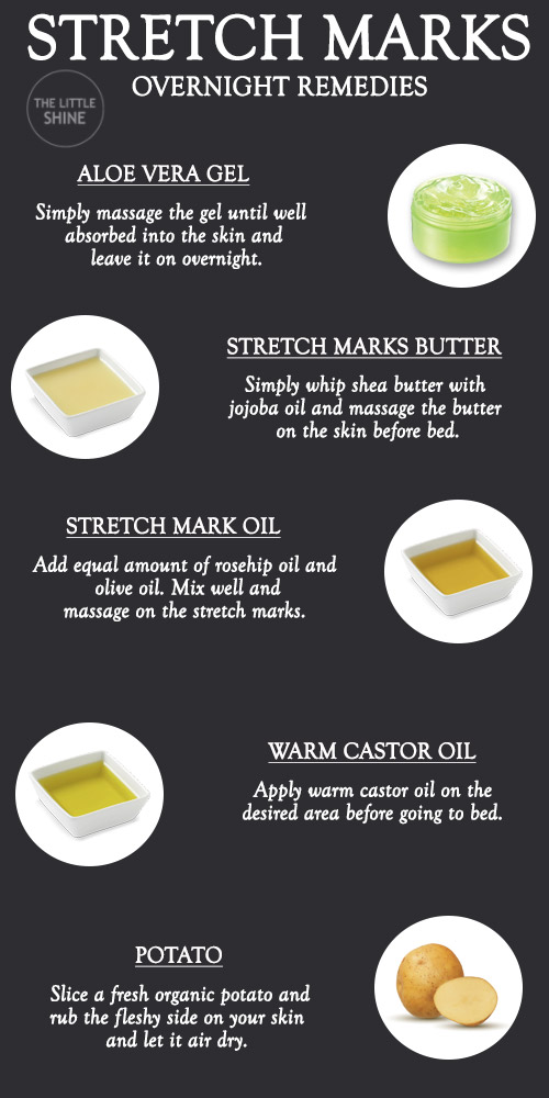 OVERNIGHT REMEDIES FOR STRETCH MARKS