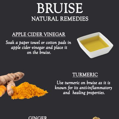 NATURAL REMEDIES TO GET RID OF BRUISE