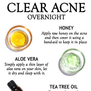 NATURAL REMEDIES TO CLEAR ACNE OVERNIGHT