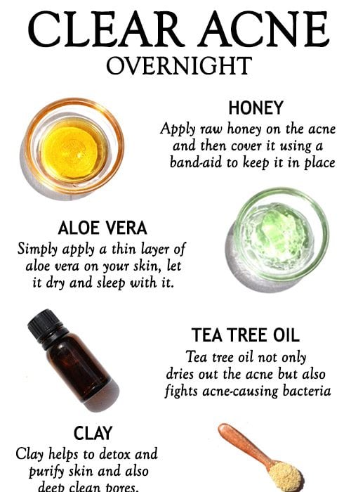 NATURAL REMEDIES TO CLEAR ACNE OVERNIGHT