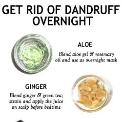 GET RID OF DANDRUFF OVERNIGHT – The Little Shine