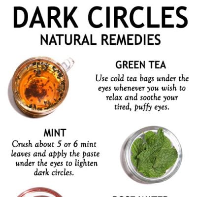 TOP 5 HOME REMEDIES FOR DARK CIRCLES