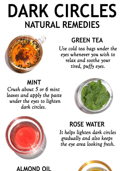 TOP 5 HOME REMEDIES FOR DARK CIRCLES