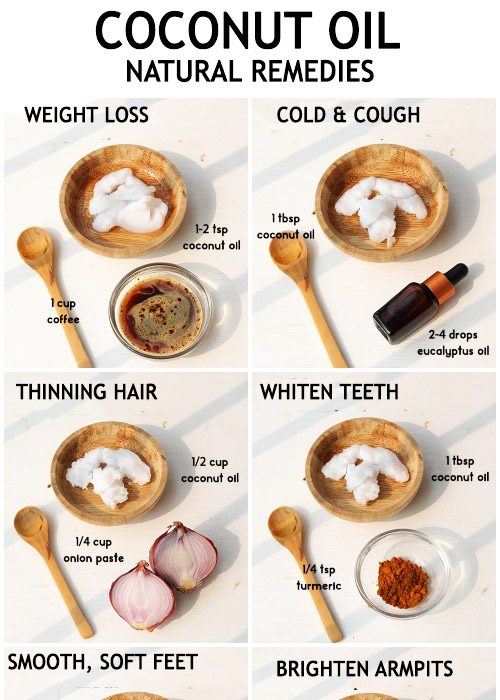 Coconut oil remedies