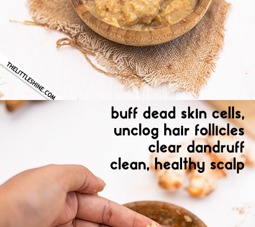 Clear dandruff and get a healthy scalp