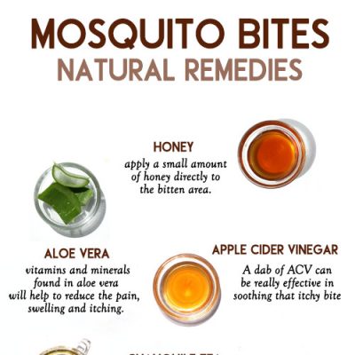 How To Relieve Mosquito Bites Naturally