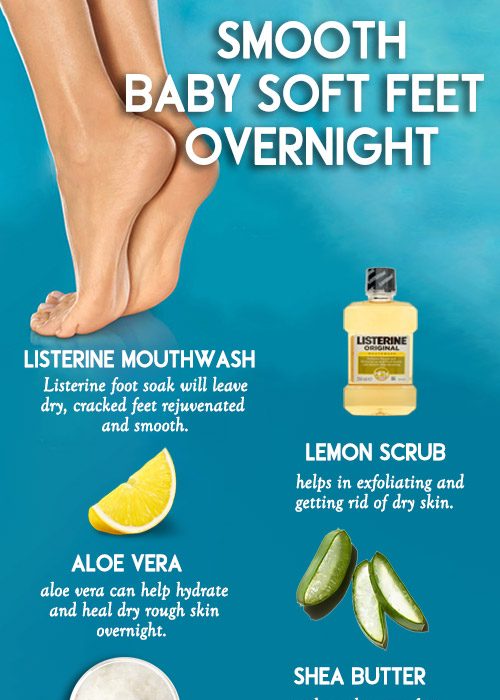 TREAT DRY ROUGH AND CRACKED HEELS OVERNIGHT WITH NATURAL REMEDIES