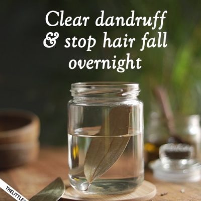 CLEAR DANDRUFF AND STOP HAIR FALL OVERNIGHT with bay leaves