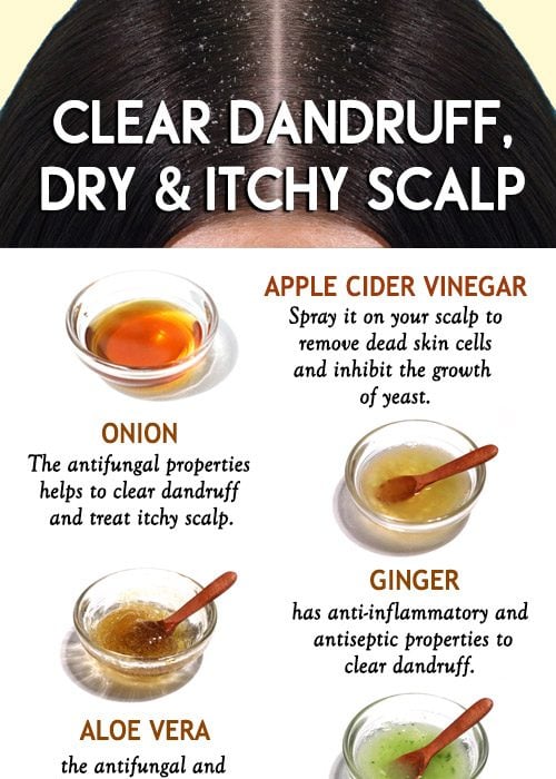 HAIR MASKS TO CLEAR DANDRUFF, DRY AND ITCHY SCALP