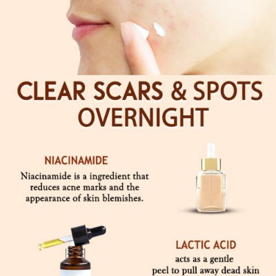 6 Best skincare ingredients to get rid of acne scars and dark spots