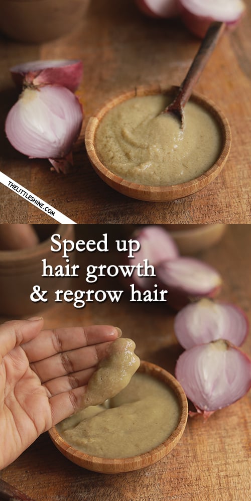 Speed Up Hair Growth with onion