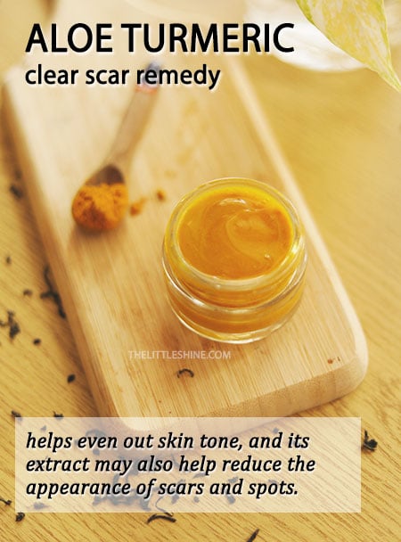 Clear scars Overnight with products and remedies
