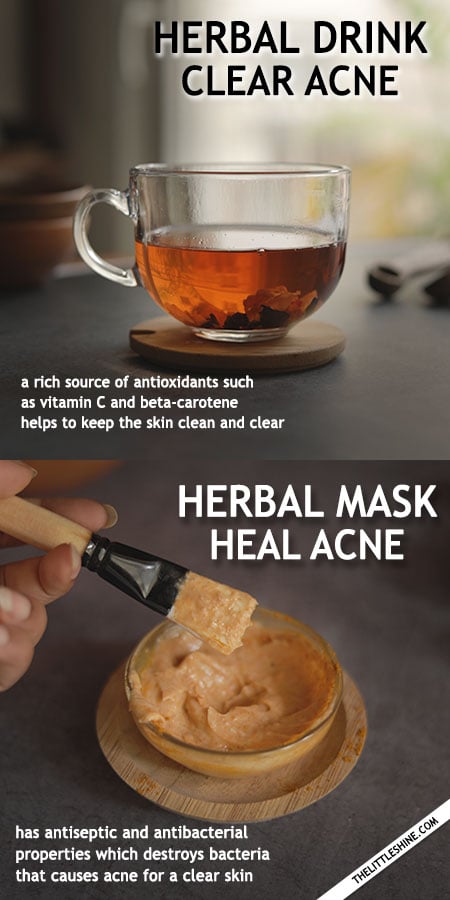 Best Herbs to Clear Acne
