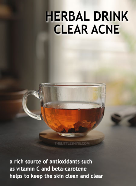 Best Herbs to Clear Acne