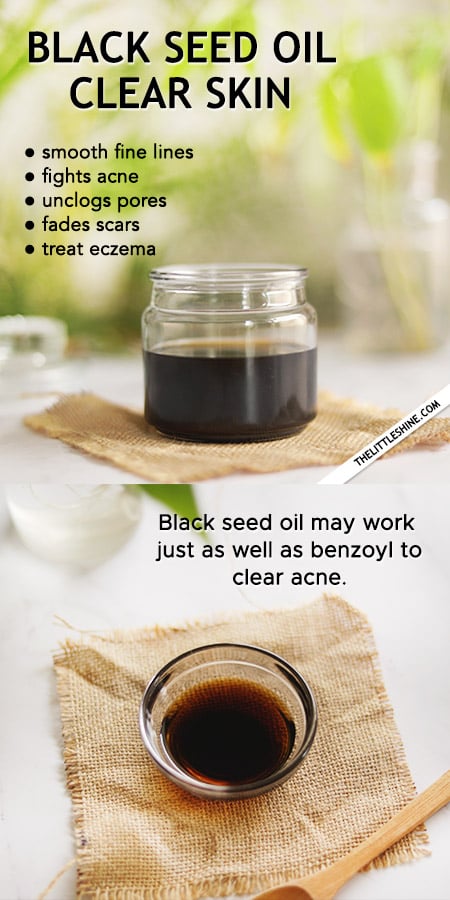 BLACK SEED OIL FOR CLEAR SKIN
