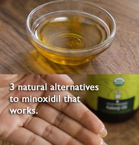 MINOXIDIL FOR HAIR GROWTH - 3 NATURAL SUBSTITUTES THAT WORK THE BEST