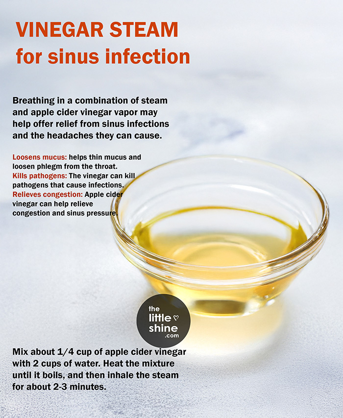 Vinegar Steam for sinus infection 