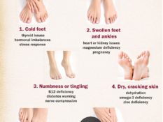 What Your Feet Say About Your Health