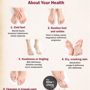 What Your Feet Say About Your Health