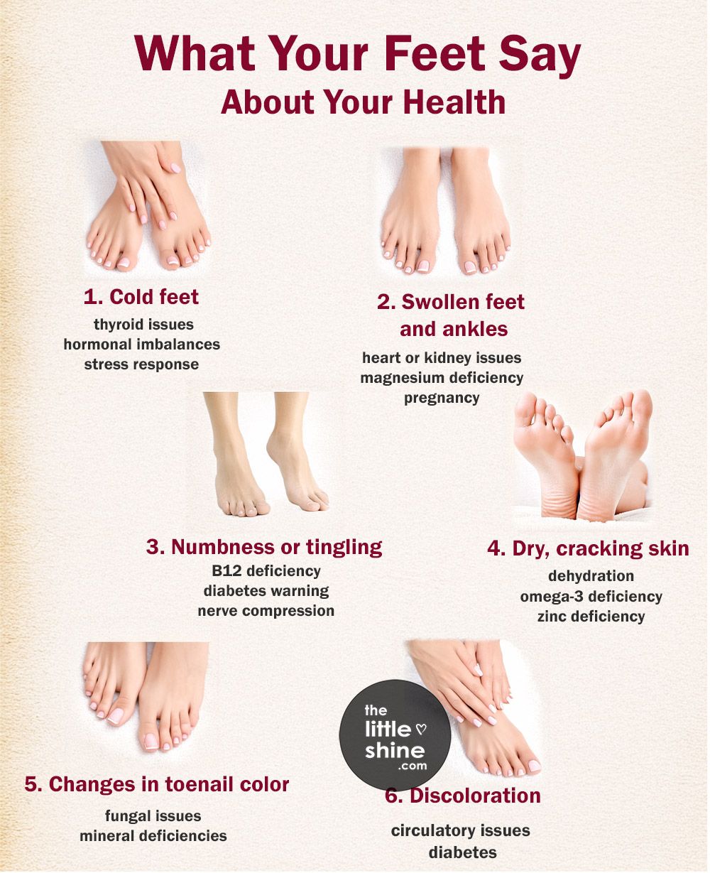 What Your Feet Say About Your Health